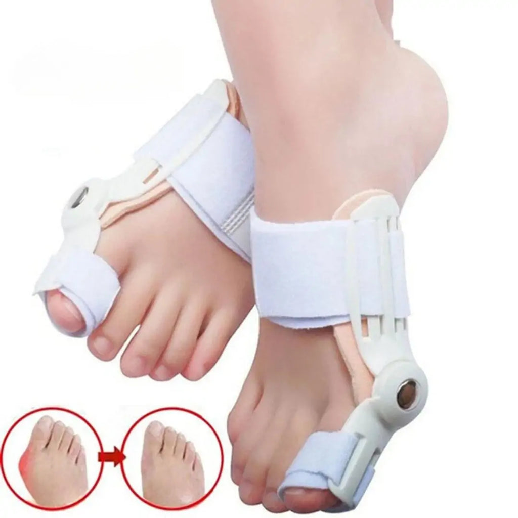 Aparat za Korekciju Čukljeva